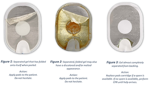 image of HeartSmart Automated External Defibrillator damaged gel pads