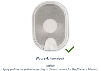 image of HeartSmart Automated External Defibrillator normal pad